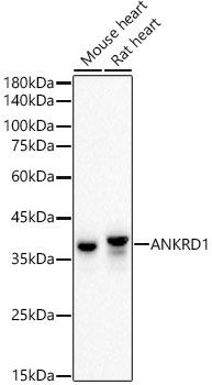 Western blot analysis of various lysates using ANKRD1 Rabbit mAb at1:2000 dilution.|Secondary antibody: HRP-conjugated Goat anti-Rabbit IgG (H+L) at 1:10000 dilution.|Lysates/proteins: 25μg per lane.|Blocking buffer: 3% nonfat dry milk in TBST.|Detection: ECL Basic Kit.|Exposure time: 60s.