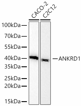 Western blot analysis of various lysates using ANKRD1 Rabbit mAb at 1:2000 dilution incubated overnight at 4℃.|Secondary antibody: HRP-conjugated Goat anti-Rabbit IgG (H+L) at 1:10000 dilution.|Lysates/proteins: 25 μg per lane.|Blocking buffer: 3% nonfat dry milk in TBST.|Detection: ECL Basic Kit.|Exposure time: 45s.