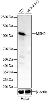 Western blot analysis of lysates from wild type(WT) and MSH2 knockout (KO) HeLa cells, using [KO Validated] MSH2 Rabbit mAb (A22177) at1:20000 dilution.|Secondary antibody: HRP-conjugated Goat anti-Rabbit IgG (H+L) (AS014) at 1:10000 dilution.|Lysates/proteins: 25μg per lane.|Blocking buffer: 3% nonfat dry milk in TBST.|Detection: ECL Basic Kit (RM00020).|Exposure time: 60s.