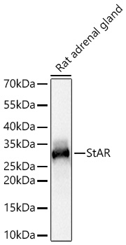 Western blot analysis of lysates from Rat adrenal gland using StAR Rabbit mAb at 1:11000 dilution incubated overnight at 4℃.|Secondary antibody: HRP-conjugated Goat anti-Rabbit IgG (H+L) at 1:10000 dilution.|Lysates/proteins: 25 μg per lane.|Blocking buffer: 3% nonfat dry milk in TBST.|Detection: ECL Basic Kit.|Exposure time: 1s.