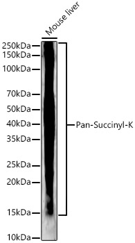 Western blot analysis of lysates from Mouse liver, using Pan-Succinyl-K Rabbit mAb at1:2000 dilution.|Secondary antibody: HRP-conjugated Goat anti-Rabbit IgG (H+L) at 1:10000 dilution.|Lysates/proteins: 25μg  per lane.|Blocking buffer: 3% nonfat dry milk in TBST.|Detection: ECL Basic Kit.|Exposure time: 180s.