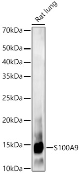 Western blot analysis of lysates from Rat lung, using S100A9 Rabbit mAb at1:2000 dilution.|Secondary antibody: HRP-conjugated Goat anti-Rabbit IgG (H+L) at 1:10000 dilution.|Lysates/proteins: 25μg per lane.|Blocking buffer: 3% nonfat dry milk in TBST.|Detection: ECL Basic Kit.|Exposure time: 60s.