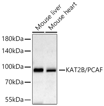 Western blot analysis of various lysates using KAT2B/PCAF Rabbit mAb at 1:1000 dilution incubated at room temperature for 1.5 hours.|Secondary antibody: HRP-conjugated Goat anti-Rabbit IgG (H+L) at 1:10000 dilution.|Lysates/proteins: 25 μg per lane.|Blocking buffer: 3% nonfat dry milk in TBST.|Detection: ECL Basic Kit.|Exposure time: 90s.