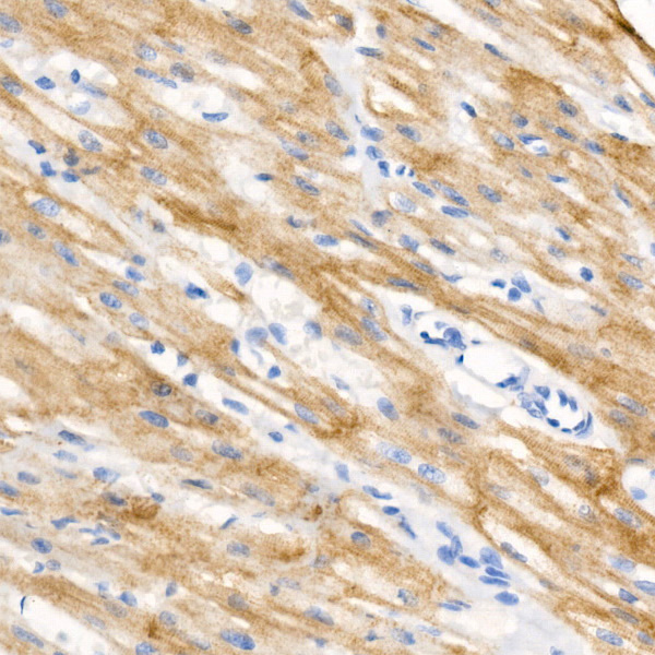 Immunohistochemistry analysis of paraffin-embedded Human heart using Phospho-Cardiac Troponin I (TNNI3)-S23/S24 Rabbit mAb at dilution of 1:700 (40x lens). High pressure antigen retrieval performed with 0.01M Citrate buffer (pH 6.0) prior to IHC staining.