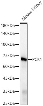 Western blot analysis of various lysates, using PCK1 Rabbit mAb at1:2000 dilution.|Secondary antibody: HRP-conjugated Goat anti-Rabbit IgG (H+L) at 1:10000 dilution.|Lysates/proteins: 25μg per lane.|Blocking buffer: 3% nonfat dry milk in TBST.|Detection: ECL Basic Kit.|Exposure time: 0.5s.