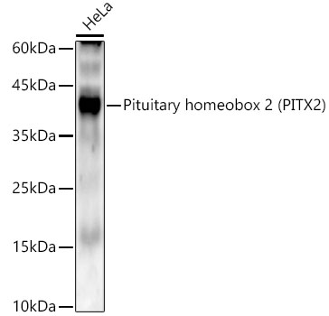 Western blot analysis of lysates from HeLa cells, using Pituitary homeobox 2 (PITX2) Rabbit mAb at1:2000 dilution.|Secondary antibody: HRP-conjugated Goat anti-Rabbit IgG (H+L) at 1:10000 dilution.|Lysates/proteins: 25μg per lane.|Blocking buffer: 3% nonfat dry milk in TBST.|Detection: ECL Enhanced Kit.|Exposure time: 90s.