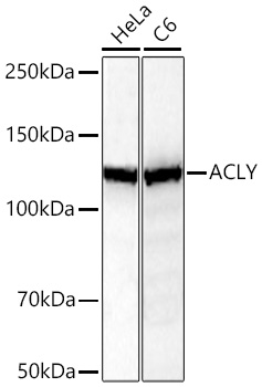 Western blot analysis of various lysates using [KO Validated] ACLY Rabbit mAb at 1:2000 dilution incubated overnight at 4℃.|Secondary antibody: HRP-conjugated Goat anti-Rabbit IgG (H+L) at 1:10000 dilution.|Lysates/proteins: 25 μg per lane.|Blocking buffer: 3% nonfat dry milk in TBST.|Detection: ECL Basic Kit.|Exposure time: 20 s.