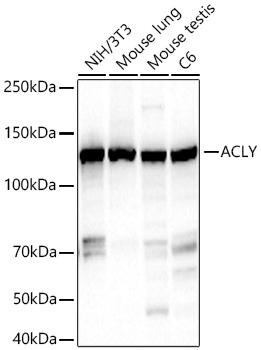 Western blot analysis of various lysates using ACLY Rabbit mAb at 1:7000 dilution incubated overnight at 4℃.|Secondary antibody: HRP-conjugated Goat anti-Rabbit IgG (H+L) at 1:10000 dilution.|Lysates/proteins: 25 μg per lane.|Blocking buffer: 3% nonfat dry milk in TBST.|Detection: ECL Basic Kit.|Exposure time: 20s.