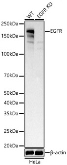 Western blot analysis of lysates from wild type(WT) and EGFR knockdown (KD) HeLa cells, using [KD Validated] EGFR Rabbit mAb (A23452) at 1:1000 dilution.|Secondary antibody: HRP-conjugated Goat anti-Rabbit IgG (H+L) (AS014) at 1:10000 dilution.|Lysates/proteins: 25μg per lane.|Blocking buffer: 3% nonfat dry milk in TBST.|Detection: ECL Basic Kit (RM00020).|Exposure time: 30s.