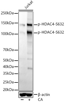 Western blot analysis of lysates from Jurkat cells, using Phospho-HDAC4-S632 Rabbit mAb at1:2000 dilution. Jurkat cells were treated with Calyculin A (100 nM) at 37℃ for 30 minutes.|Secondary antibody: HRP-conjugated Goat anti-Rabbit IgG (H+L) at 1:10000 dilution.|Lysates/proteins: 25μg per lane.|Blocking buffer: 3% nonfat dry milk in TBST.|Detection: ECL Basic Kit.|Exposure time: 10s.