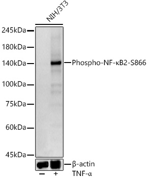Western blot analysis of lysates from NIH/3T3 cells, using Phospho-NF-κB2-S866 Rabbit mAb at 1:500 dilution. NIH/3T3 cells were treated with TNF-α (20 ng/ml) at 37℃ for 30 minutes.|Secondary antibody: HRP-conjugated Goat anti-Rabbit IgG (H+L) at 1:10000 dilution.|Lysates/proteins: 25μg per lane.|Blocking buffer: 3% nonfat dry milk in TBST.|Detection: ECL Basic Kit.|Exposure time: 30s.