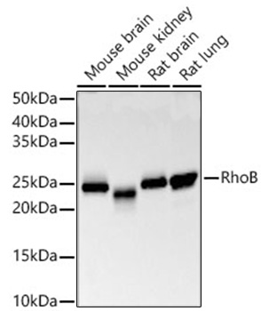 Western blot analysis of various lysates, using RhoB Rabbit mAb at 1:20000 dilution.|Secondary antibody: HRP-conjugated Goat anti-Rabbit IgG (H+L) at 1:10000 dilution.|Lysates/proteins: 25 μg per lane.|Blocking buffer: 3% nonfat dry milk in TBST.|Detection: ECL Basic Kit.|Exposure time: 30 s.