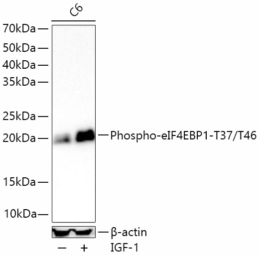 Western blot analysis of lysates from C6 cells using Phospho-eIF4EBP1-T37/T46 Rabbit mAb at 1:7000 dilution incubated overnight at 4℃. C6 cells were treated with IGF-1 (100 ng/mL) at 37℃ for 30 minutes after serum-starvation overnight|Secondary antibody: HRP-conjugated Goat anti-Rabbit IgG (H+L) at 1:10000 dilution.|Lysates/proteins: 30 μg per lane.| Blocking buffer: 3% nonfat dry milk in TBST.| Detection: ECL Basic Kit.| Exposure time: 180s.