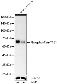 Western blot analysis of various lysates, using Phospho-Tau-T181 antibody at  1:2000 dilution. Mouse brain were treated by λ-PP mixed solution (1ul) at 30℃ for 30 minutes.|Secondary antibody: HRP-conjugated Goat anti-Rabbit IgG (H+L) at 1:10000 dilution.|Lysates/proteins: 25μg  per lane.|Blocking buffer: 3% nonfat dry milk in TBST.|Detection: ECL Enhanced Kit.|Exposure time: 60s.