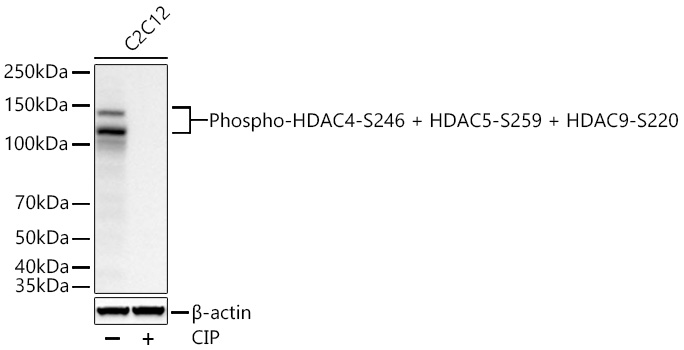 Western blot analysis of lysates from C2C12 cells using Phospho-HDAC4-S246 + HDAC5-S259 + HDAC9-S220 Rabbit mAb at 1:1000 dilution incubated at room temperature for 1.5 hours. C2C12 treated with CIP (1 U/ul) at 37℃ for 1 hour.|Secondary antibody: HRP-conjugated Goat anti-Rabbit IgG (H+L) at 1:10000 dilution.|Lysates/proteins: 30 μg per lane.| Blocking buffer: 3% nonfat dry milk in TBST.| Detection: ECL Basic Kit.| Exposure time: 30 s.