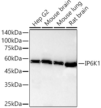 Western blot analysis of various lysates using [KD Validated] IP6K1 Rabbit mAb (A26975) at 1:2500 dilution incubated overnight at 4℃.|Secondary antibody: HRP-conjugated Goat anti-Rabbit IgG (H+L) (AS014) at 1:10000 dilution.|Lysates/proteins: 25 μg per lane.|Blocking buffer: 3% nonfat dry milk in TBST.|Detection: ECL Basic Kit (RM00020).|Exposure time: 60s.