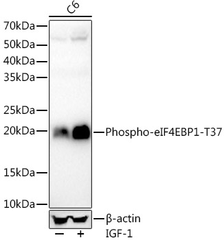 Western blot analysis of lysates from C6 cells, using Phospho-eIF4EBP1-T37 Rabbit mAb at 1:1000 dilution.C6 cells were treated with IGF-1 (100 ng/ml) at 37℃ for 30 minutes after serum-starvation overnight.Secondary antibody: HRP-conjugated Goat anti-Rabbit IgG (H+L) at 1:10000 dilution.Lysates/proteins: 25μg per lane.Blocking buffer: 3% nonfat dry milk in TBST.Detection: ECL Enhanced Kit.Exposure time: 60s.