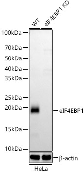 Western blot analysis of lysates from wild type(WT) and eIF4EBP1 knockdown (KD) HeLa cells, using [KD Validated] eIF4EBP1 Rabbit mAb at 1:2000 dilution.|Secondary antibody: HRP-conjugated Goat anti-Rabbit IgG (H+L) at 1:10000 dilution.|Lysates/proteins: 25μg  per lane.|Blocking buffer: 3% nonfat dry milk in TBST.|Detection: ECL Basic Kit.|Exposure time: 180s.