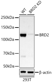 Western blot analysis of lysates from wild type (WT) and BRD2 knockdown (KD) 293T cells using [KD Validated] BRD2 Rabbit mAb (A23166) at 1:1000 dilution incubated at room temperature for 1.5 hours.|Secondary antibody: HRP-conjugated Goat anti-Rabbit IgG (H+L) (AS014) at 1:10000 dilution.|Lysates/proteins: 25 μg per lane.|Blocking buffer: 3% nonfat dry milk in TBST.|Detection: ECL Basic Kit (RM00020).|Exposure time: 90s.