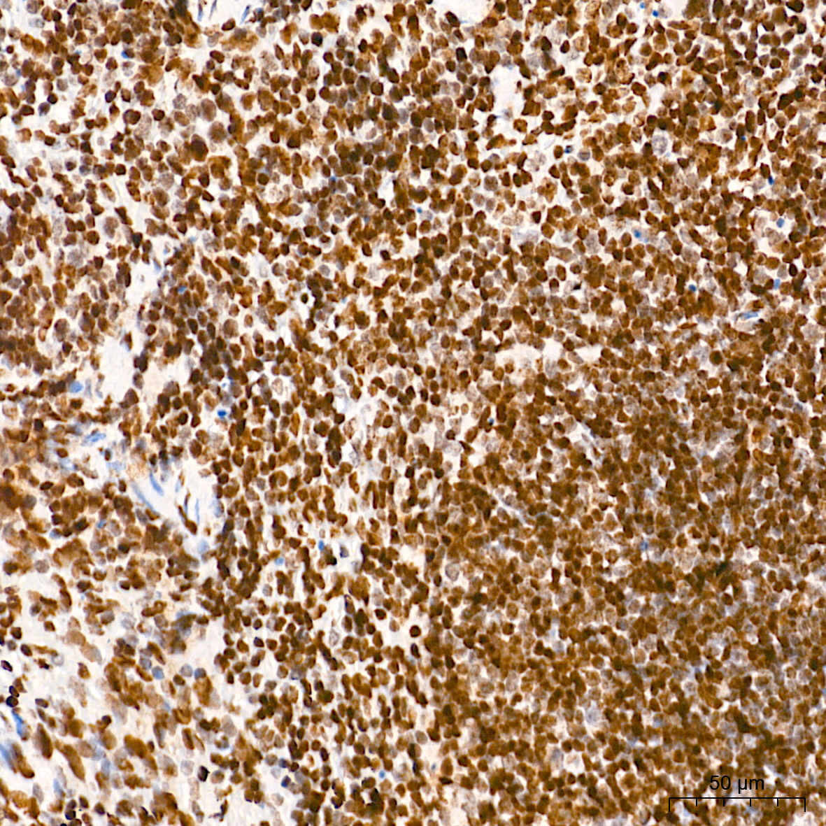 Immunohistochemistry analysis of paraffin-embedded Mouse spleen tissue using WEE1 Rabbit mAb at a dilution of 1:1000 (40x lens). High pressure antigen retrieval performed with 0.01M Tris-EDTA Buffer (pH 9.0) prior to IHC staining.