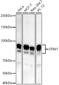 Western blot analysis of various lysates, using STIM1 Rabbit mAb at 1:2000 dilution.|Secondary antibody: HRP-conjugated Goat anti-Rabbit IgG (H+L) at 1:10000 dilution.|Lysates/proteins: 25μg per lane.|Blocking buffer: 3% nonfat dry milk in TBST.|Detection: ECL Basic Kit.|Exposure time: 180s.