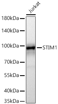 Western blot analysis of lysates from Jurkat cells using STIM1 Rabbit mAb at 1:9000 dilution incubated overnight at 4℃.|Secondary antibody: HRP-conjugated Goat anti-Rabbit IgG (H+L) at 1:10000 dilution.|Lysates/proteins: 25 μg per lane.|Blocking buffer: 3% nonfat dry milk in TBST.|Detection: ECL Basic Kit.|Exposure time: 1s.