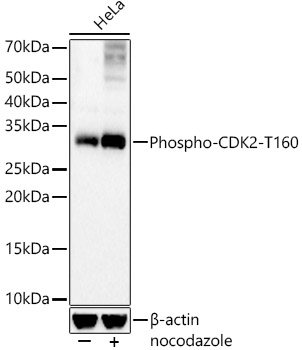 Western blot analysis of lysates from HeLa cells, using Phospho-CDK2-T160 Rabbit mAb at 1:5000 dilution. HeLa cells were treated with nocodazole (50 ng/ml) at 37℃ for 20 hours.|Secondary antibody: HRP-conjugated Goat anti-Rabbit IgG (H+L) at 1:10000 dilution.|Lysates/proteins: 25μg per lane.|Blocking buffer: 3% nonfat dry milk in TBST.|Detection: ECL Basic Kit.|Exposure time: 90s.