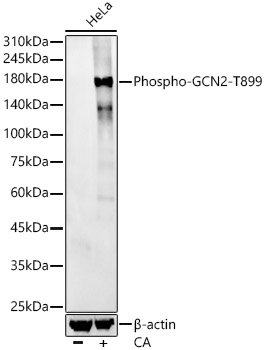 Western blot analysis of various lysates, using Phospho-GCN2-T899 Rabbit mAb at1:2000 dilution. HeLa cells were treated with Calyculin A (100 nM) at 37℃ for 30 minutes after serum-starvation overnight.|Secondary antibody: HRP-conjugated Goat anti-Rabbit IgG (H+L) at 1:10000 dilution.|Lysates/proteins: 25μg per lane.|Blocking buffer: 3% nonfat dry milk in TBST.|Detection: ECL Basic Kit.|Exposure time: 180s.