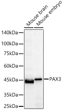 Western blot analysis of various lysates using PAX3 Rabbit mAb at 1:1000 dilution incubated overnight at 4℃.|Secondary antibody: HRP-conjugated Goat anti-Rabbit IgG (H+L) at 1:10000 dilution.|Lysates/proteins: 25 μg per lane.|Blocking buffer: 3% nonfat dry milk in TBST.|Detection: ECL Basic Kit.|Exposure time: 30s.