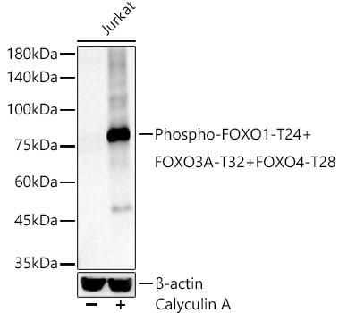 Western blot analysis of lysates from Jurkat cells, using Phospho-FOXO1-T24 + FOXO3A-T32 + FOXO4-T28 Rabbit mAb at 1:2000 dilution. Jurkat cells were treated with Calyculin A (100 nM) at 37℃ for 30 minutes.|Secondary antibody: HRP-conjugated Goat anti-Rabbit IgG (H+L) at 1:10000 dilution.|Lysates/proteins: 25μg per lane.|Blocking buffer: 3% nonfat dry milk in TBST.|Detection: ECL Basic Kit.|Exposure time: 20s.
