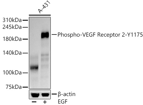 Western blot analysis of lysates from A-431 lysates cells, using Phospho-VEGF Receptor 2-Y1175 Rabbit mAb at  1:3000 dilution. A-431 cells were treated with EGF (100 ng/ml) at 37℃ for 30 minutes after serum-starvation overnight.|Secondary antibody: HRP-conjugated Goat anti-Rabbit IgG (H+L) at 1:10000 dilution.|Lysates/proteins: 25μg per lane.|Blocking buffer: 3% nonfat dry milk in TBST.|Detection: ECL Basic Kit.|Exposure time: 90s.
