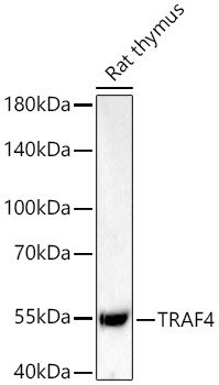 Western blot analysis of lysates from Rat thymus using TRAF4 Rabbit mAb (A22472) at 1:5000 dilution incubated overnight at 4℃.|Secondary antibody: HRP-conjugated Goat anti-Rabbit IgG (H+L) (AS014) at 1:10000 dilution.|Lysates/proteins: 25 μg per lane.|Blocking buffer: 3% nonfat dry milk in TBST.|Detection: ECL Basic Kit (RM00020).|Exposure time: 45 s.