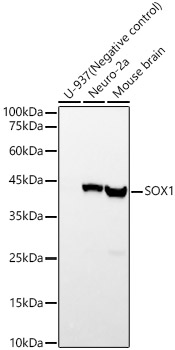 Western blot analysis of various lysates, using SOX1 Rabbit mAb at 1:2000 dilution.|Secondary antibody: HRP-conjugated Goat anti-Rabbit IgG (H+L) at 1:10000 dilution.|Lysates/proteins: 25μg per lane.|Blocking buffer: 3% nonfat dry milk in TBST.|Detection: ECL Basic Kit.|Exposure time: 10s.