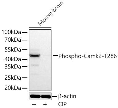Western blot analysis of lysates from Mouse brain using Phospho-Camk2-T286 Rabbit mAb at 1:1000 dilution incubated at room temperature for 1.5 hours. Mouse brain treated with CIP (1U/ul) at 37℃ for 1 hours.|Secondary antibody: HRP-conjugated Goat anti-Rabbit IgG (H+L) at 1:10000 dilution.|Lysates/proteins: 30 μg per lane.|Blocking buffer: 3% nonfat dry milk in TBST.|Detection: ECL Basic Kit.|Exposure time: 45 s.