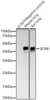 Western blot analysis of various lysates, using SFTPD Rabbit mAb at 1:20000 dilution.|Secondary antibody: HRP-conjugated Goat anti-Rabbit IgG (H+L) at 1:10000 dilution.|Lysates/proteins: 25μg per lane.|Blocking buffer: 3% nonfat dry milk in TBST.|Detection: ECL Basic Kit.|Exposure time: 180s.