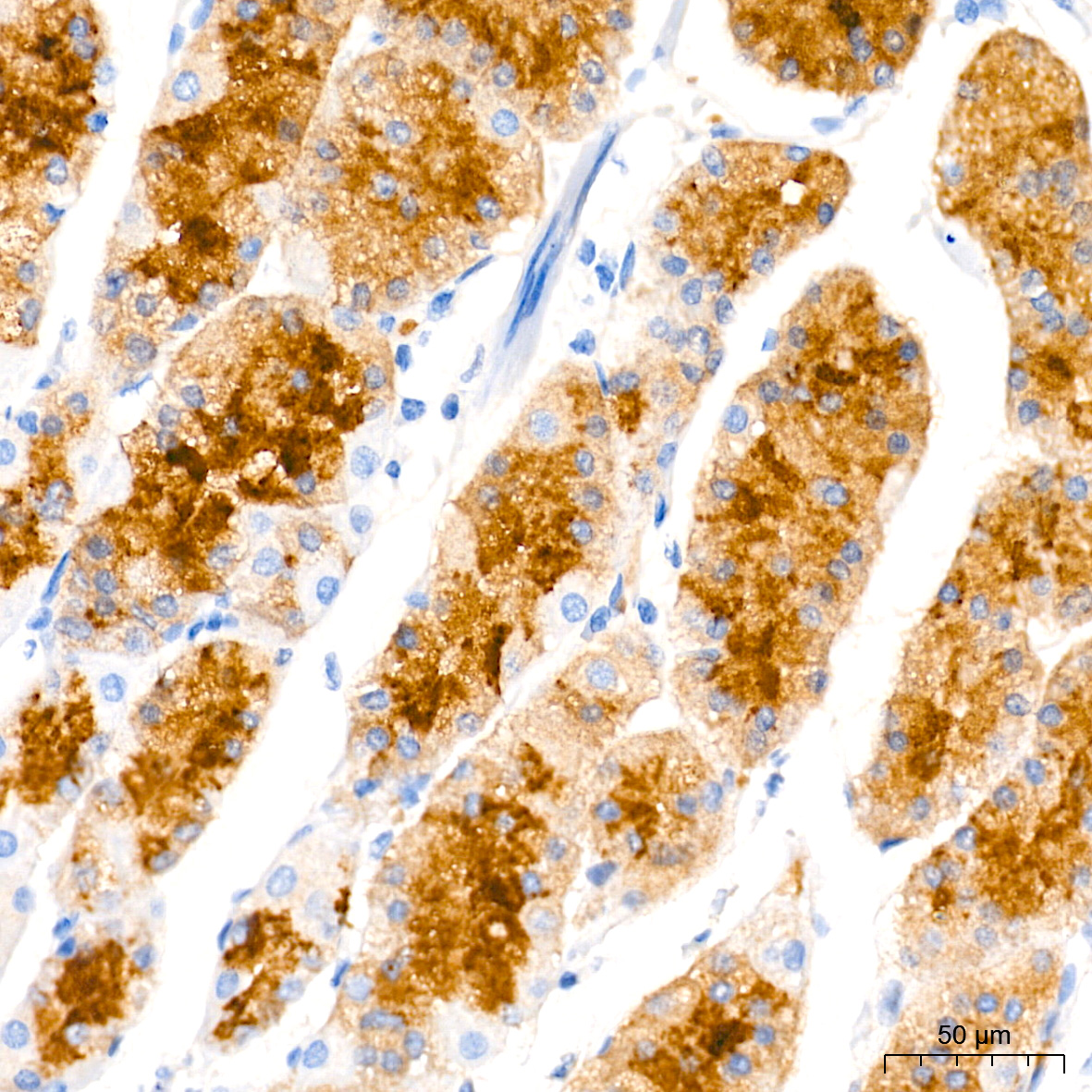 Immunohistochemistry analysis of paraffin-embedded Human stomach tissue using Pepsinogen II (PG II) Rabbit mAb at a dilution of 1:1000 (40x lens). High pressure antigen retrieval performed with 0.01M Tris-EDTA Buffer (pH 9.0) prior to IHC staining.