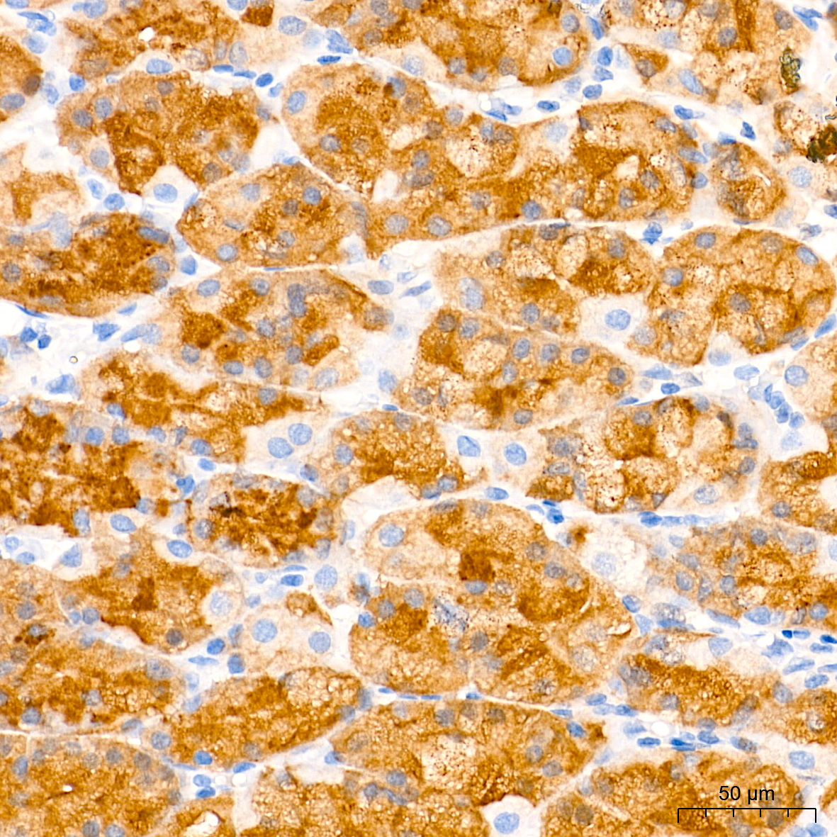 Immunohistochemistry analysis of paraffin-embedded Human stomach tissue using Pepsinogen II (PG II) Rabbit mAb at a dilution of 1:10000 (40x lens). High pressure antigen retrieval performed with 0.01M Tris-EDTA Buffer (pH 9.0) prior to IHC staining.