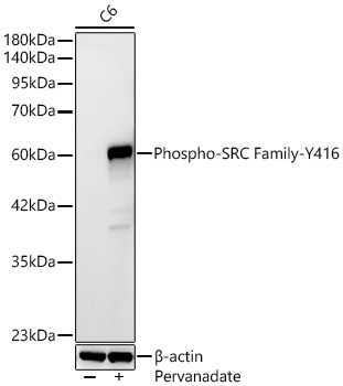Western blot analysis of lysates from C6 cells using Phospho-SRC Family-Y416 Rabbit mAb at 1:1000 dilution. C6 cells were treated with Pervanadate (0.5 mM) at 37℃ for 40 minutes.|Secondary antibody: HRP-conjugated Goat anti-Rabbit IgG (H+L) at 1:10000 dilution.|Lysates/proteins: 25 μg per lane.|Blocking buffer: 3% nonfat dry milk in TBST.|Detection: ECL Basic Kit.|Exposure time: 90s.