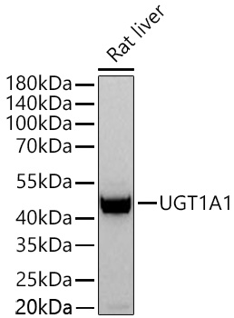 Western blot analysis of lysates from Rat liver using UGT1A1 Rabbit mAb at 1:2000 dilution incubated at room temperature for 1.5 hours.|Secondary antibody: HRP-conjugated Goat anti-Rabbit IgG (H+L) at 1:10000 dilution.|Lysates/proteins: 25 μg per lane.|Blocking buffer: 3% nonfat dry milk in TBST.|Detection: ECL Basic Kit.|Exposure time: 90 s.