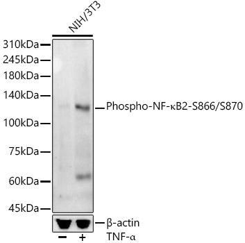 Western blot analysis of lysates from NIH/3T3 cells, using Phospho-NF-κB2-S866/S870 Rabbit mAb at  1:4000 dilution. NIH/3T3 cells were treated with TNF-α (20 ng/ml) at 37℃ for 30 minutes.|Secondary antibody: HRP-conjugated Goat anti-Rabbit IgG (H+L) at 1:10000 dilution.|Lysates/proteins: 25μg per lane.|Blocking buffer: 3% nonfat dry milk in TBST.|Detection: ECL Basic Kit.|Exposure time: 180s.