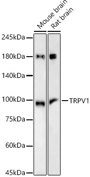 Western blot analysis of various lysates, using TRPV1 Rabbit mAb (A23386) at 1:500 dilution.|Secondary antibody: HRP-conjugated Goat anti-Rabbit IgG (H+L) (AS014) at 1:10000 dilution.|Lysates/proteins: 25μg per lane.|Blocking buffer: 3% nonfat dry milk in TBST.|Detection: ECL Basic Kit (RM00020).|Exposure time: 180s.