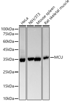 Western blot analysis of various lysates, using [KO Validated] MCU Rabbit mAb (A22525) at1:20000 dilution.|Secondary antibody: HRP-conjugated Goat anti-Rabbit IgG (H+L) (AS014) at 1:10000 dilution.|Lysates/proteins: 25μg per lane.|Blocking buffer: 3% nonfat dry milk in TBST.|Detection: ECL Basic Kit (RM00020).|Exposure time: 90s.