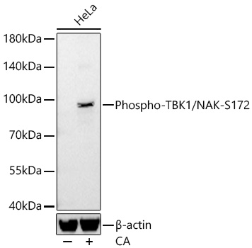 Western blot analysis of lysates from HeLa cells using Phospho-TBK1/NAK-S172 Rabbit mAb at 1:1000 dilution incubated overnight at 4℃. HeLa cells were treated with Calyculin A (100 nM) at 37℃ for 30 minutes after serum-starvation overnight.|Secondary antibody: HRP-conjugated Goat anti-Rabbit IgG (H+L) at 1:10000 dilution.|Lysates/proteins: 30 μg per lane.| Blocking buffer: 3 % nonfat dry milk in TBST.| Detection: ECL Basic Kit.| Exposure time: 90s.