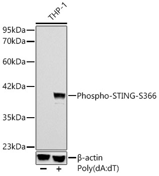 Western blot analysis of lysates from THP-1 cells, using Phospho-STING/TMEM173-S366 Rabbit mAb at 1:1000 dilution. THP-1 cells were transfection with poly(dA:dT) (5μg/mL) for 3 hours.|Secondary antibody: HRP-conjugated Goat anti-Rabbit IgG (H+L) at 1:10000 dilution.|Lysates/proteins: 25μg per lane.|Blocking buffer: 3% nonfat dry milk in TBST.|Detection: ECL Basic Kit.|Exposure time: 10s.