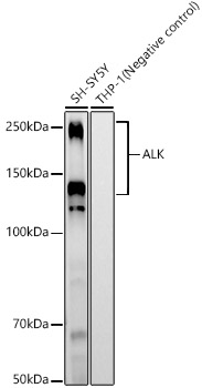 Western blot analysis of various lysates, using ALK Rabbit mAb at  1:2000 dilution.|Secondary antibody: HRP-conjugated Goat anti-Rabbit IgG (H+L) at 1:10000 dilution.|Lysates/proteins: 25μg per lane.|Blocking buffer: 3% nonfat dry milk in TBST.|Detection: ECL Basic Kit.|Exposure time: 180s.