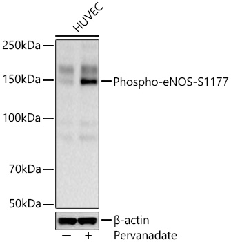 Western blot analysis of lysates from HUVEC cells using Phospho-eNOS-S1177 Rabbit mAb at 1:6000 dilution incubated overnight at 4℃. HUVEC cells were treated with Pervanadate (100 μM) at 37℃ for 10 minutes.|Secondary antibody: HRP-conjugated Goat anti-Rabbit IgG (H+L) at 1:10000 dilution.|Lysates/proteins: 30 μg per lane.| Blocking buffer: 3% nonfat dry milk in TBST.| Detection: ECL Basic Kit.| Exposure time: 60 s.