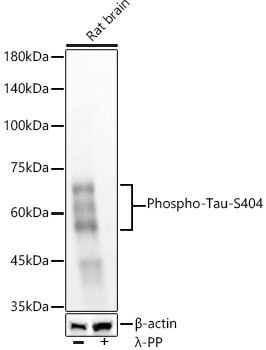 Western blot analysis of lysates from rat brain, using Phospho-Tau-S404 Rabbit mAb at  1:5000 dilution. Rat brain cells were treated with λ-PP mixed solution (1ul) at 30℃ for 30 minutes.|Secondary antibody: HRP-conjugated Goat anti-Rabbit IgG (H+L) at 1:10000 dilution.|Lysates/proteins: 25μg per lane.|Blocking buffer: 3% nonfat dry milk in TBST.|Detection: ECL Basic Kit.|Exposure time: 10s.