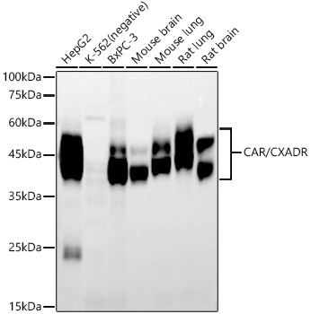 Western blot analysis of various lysates, using CAR/CXADR Rabbit mAb at 1:10000 dilution.|Secondary antibody: HRP-conjugated Goat anti-Rabbit IgG (H+L) at 1:10000 dilution.|Lysates/proteins: 25μg per lane.|Blocking buffer: 3% nonfat dry milk in TBST.|Detection: ECL Enhanced Kit.|Exposure time: 60s.