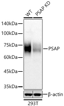 Western blot analysis of lysates from wild type (WT) and PSAP knockdown (KD) 293T cells using [KD Validated] PSAP Rabbit mAb (A26987) at 1:1000 dilution incubated overnight at 4℃.|Secondary antibody: HRP-conjugated Goat anti-Rabbit IgG (H+L) (AS014) at 1:10000 dilution.|Lysates/proteins: 25 μg per lane.|Blocking buffer: 3% nonfat dry milk in TBST.|Detection: ECL Basic Kit (RM00020).|Exposure time: 90s.