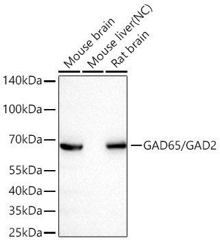 Western blot analysis of various lysates using GAD65/GAD2 Rabbit mAb at 1:73000 dilution incubated overnight at 4℃.|Secondary antibody: HRP-conjugated Goat anti-Rabbit IgG (H+L) at 1:10000 dilution.|Lysates/proteins: 25 μg per lane.|Blocking buffer: 3% nonfat dry milk in TBST.|Detection: ECL Basic Kit.|Negative control (NC): Mouse liver|Exposure time: 20s.